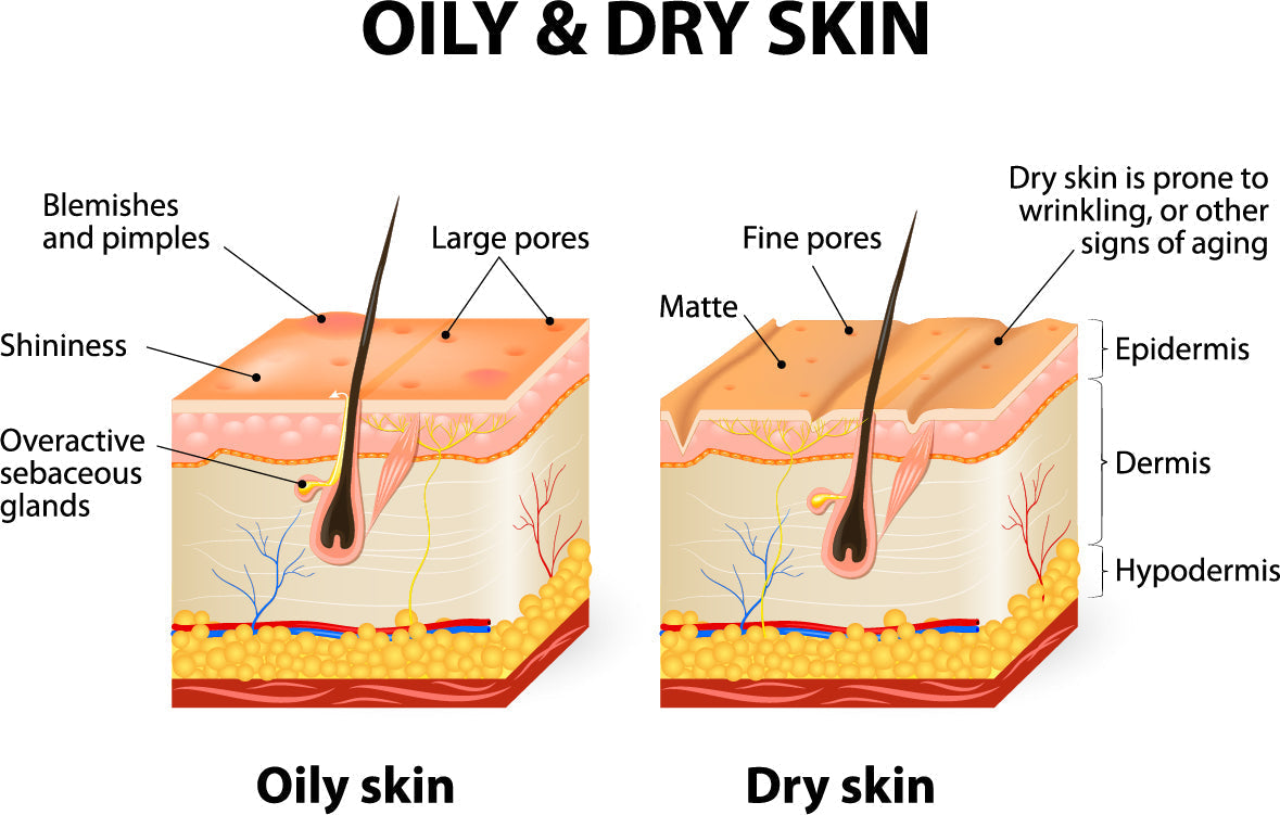 Your skin will not stop being oily? Here is what to do about it!